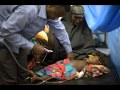 MSF Frontline Reports podcast, Ep 102: Fighting a Deadly Measles Outbreak Amid Insecurity in Somalia