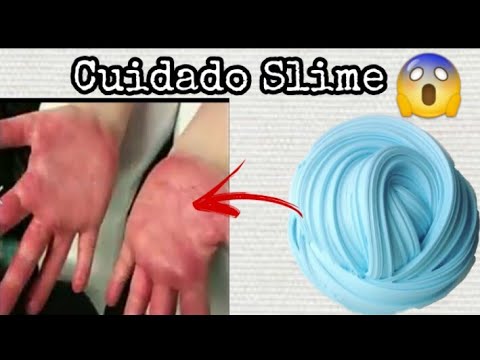 O slime faz mal