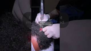 Afro Long Hair FUE Only at DrT Hair!