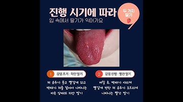 흥미로운 감염이야기 - 입 속의 딸기, 성홍열(scarlet fever)편