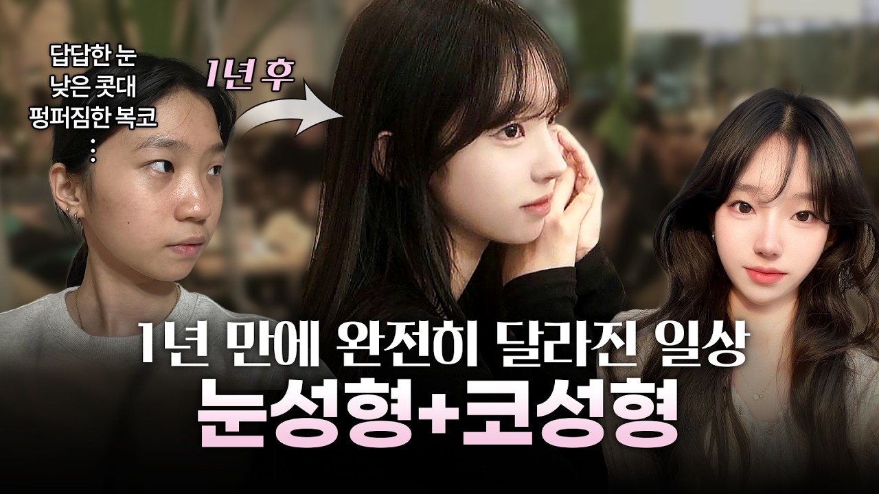 답답한 눈·뭉툭한 코 탈출! 눈·코 성형 후 1년 만에 완전히 달라진 일상ㅣ디에이성형외과ㅣ성형후기브이로그