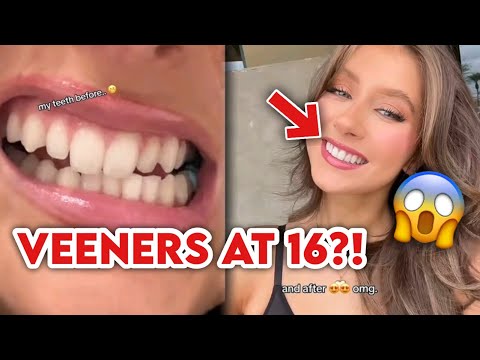 Elliana Walmsley with VENEERS at 16 Years Old?! - YouTube