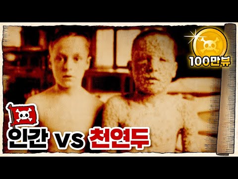 💀 역사상 가장 많은 사람을 죽인 바이러스 / 💀 천연두는 얼마나 무서웠을까?