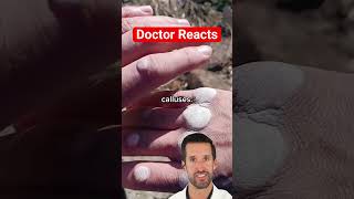 Er Doctor Reacts To Worlds Largest Hand Callus