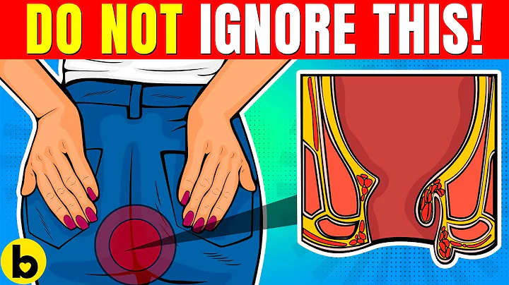 Early Warning Signs Of Colon Cancer You Should NOT IGNORE - DayDayNews
