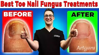 The Best Nail Fungus Treatment Exposed - Experts Agree!