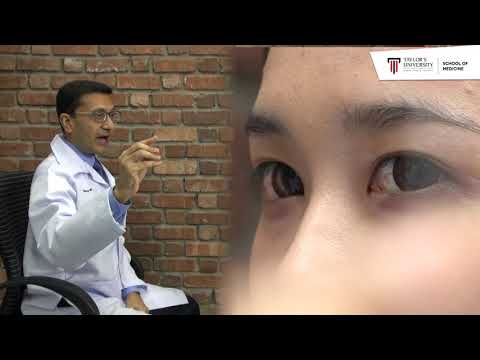 Checking Ocular Motility (Dr Prabal Bhargava)