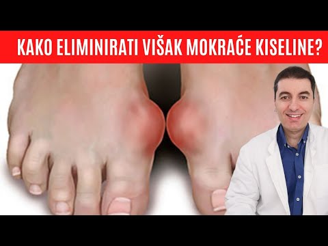 How to eliminate excess UREATIC ACID from the body? Essential for gout and kidney stones ...