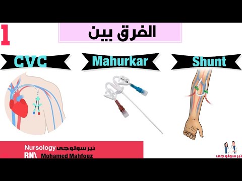 الفرق بين   