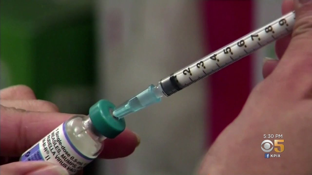 Santa Clara County Measles Exposure: Interview With Pediatrician - YouTube