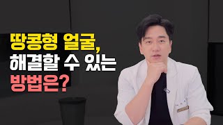 땅콩형 얼굴 해결법이 있다?! ㅣ 관자놀이 필러 스컬트라 효과 후기 부작용 ㅣ 청담동 금손 김원장