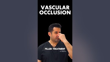 Vascular Occlusion #shorts