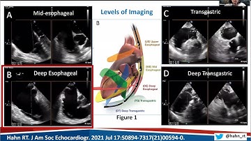 Part 1: Introduction to the Guidelines and Review of Aortic and Mitral Imaging