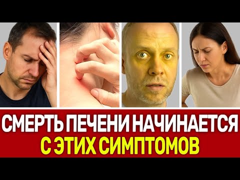 ПРИЗНАКИ, ЧТО ВАША