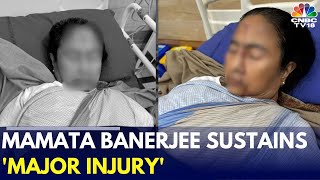 West Bengal CM Mamata Banerjee Sustains 'Major Injury', Admitted In Kolkata's SSKM Hospital | TMC