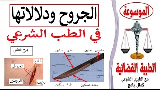 الجروح ودلالاتها في الطب الشرعي