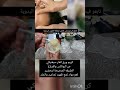 كريم ورق الغار سيغنيكي عن البوتكس والفيلر الطريقه الصحيحة لتحضير اهم مواد لمنع ظهور تجاعيد والجلد 