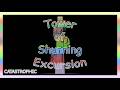 Tower of Shunning Excursion - Completion (EToH Pit of Misery)
