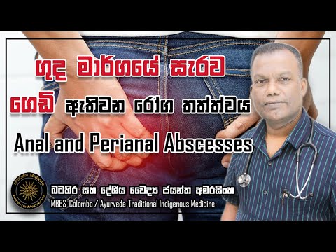 ගුද මාර්ගයේ සැරව ගෙඩි ඇතිවන රෝග තත්ත්වය | Anal and Perianal Abscesses