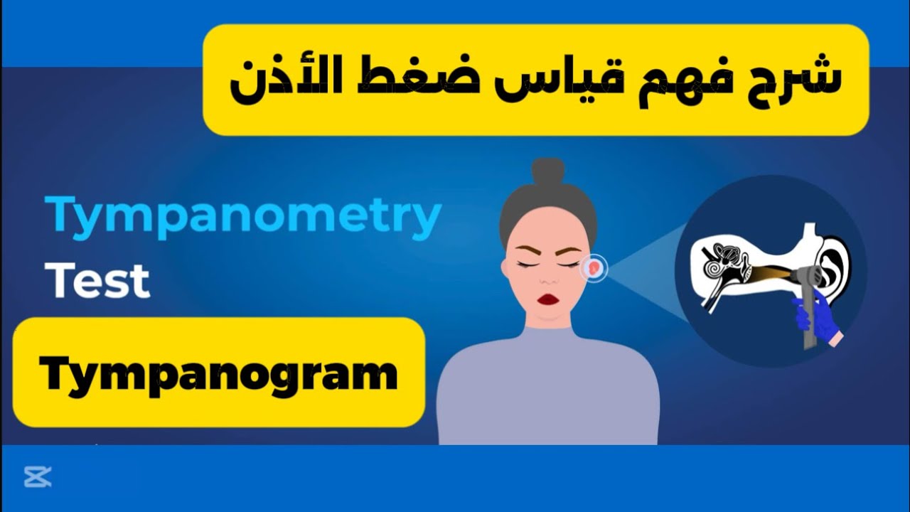 شرح قراءة ضغط الأذن خطوة بخطوة Tympanogram شرح عملي شامل | Audiology Academy السمعيات بالعربي