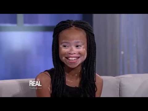 Winnie Harlow Surprises