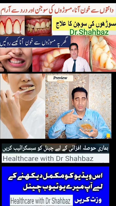 Download lagu Masoron Ki Sujan Ka ilaj In Urdu | Masoro Ka ilaj | Masoron Ki Sujan Aur Bleeding Ka Gharelu Ilaj