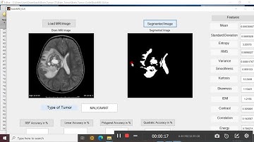 Brain MRI Tumor Detection and Classification
