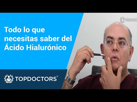 Todo lo que