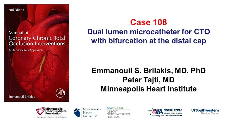 Case 108: Manual of CTO Interventions - Dual lumen microcatheter for bifurcation at the distal cap