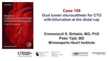 Case 108: Manual of CTO Interventions - Dual lumen microcatheter for bifurcation at the distal cap