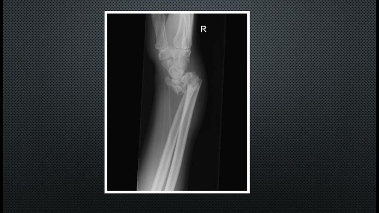 X-RAY QUIZ -PART 3 (MISCELLANEOUS XRAYS ) - YouTube