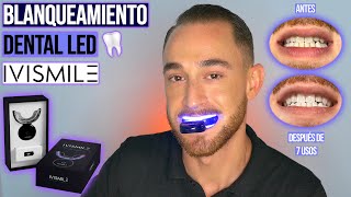 BLANQUEAMIENTO DENTAL CON LUZ LED