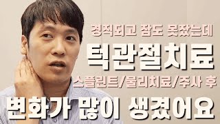 [턱관절 턱통증 해결] 스플린트 & 물리치료 & 턱관절보톡스 주사치료 다 받아봤죠! 턱관절치료 후기