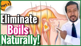 5 Natural Ways to Get Rid of Boils | Treat a Boil at Home FAST screenshot 3