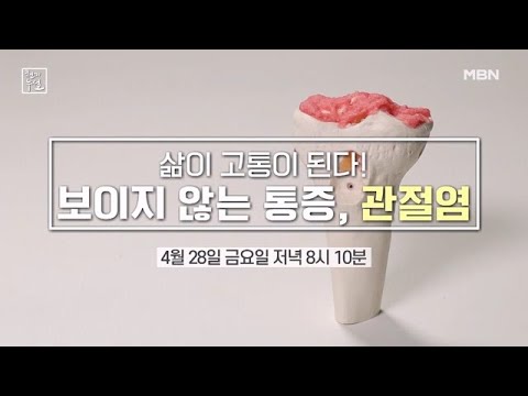 지옥 같은 고통 관절염! 수술 없이 내 무릎을 사수하라! MBN 230428 방송