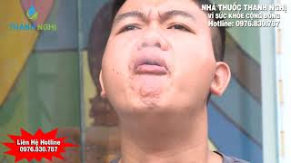 Tác hại của thuốc lào sự thật nguy hiểm và lời cảnh tỉnh không thể bỏ ngỏ