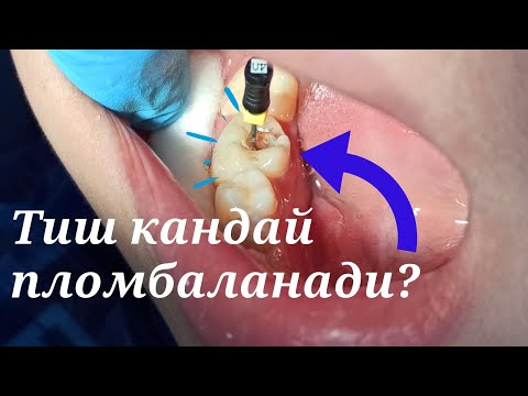 Video: Qanday qilib ortodontist bo'lish mumkin (rasmlar bilan)