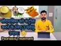 Best 3 home remedies for psoriasis patients  psoriasis treatment  nitin saini official