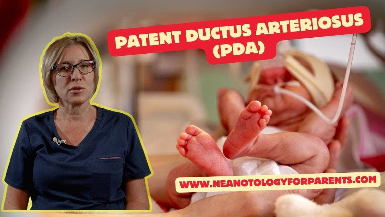 Patent Ductus Arteriosus PDA - YouTube