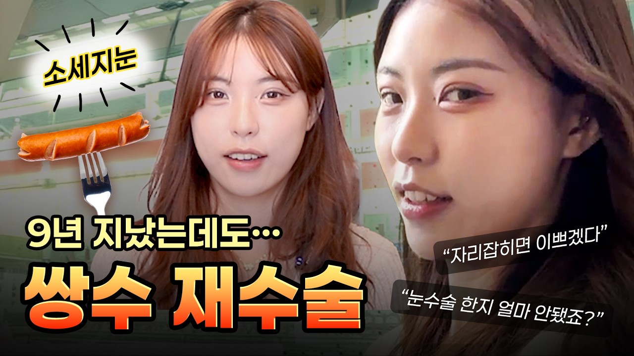 9년 전 쌍수인데… 아직도 ‘자리 잡으면 예뻐진다’는 소리 듣습니다