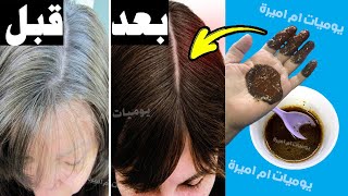 علاج شيب الشعر نهائيا  و من غير صبغه 3 مكونات فقط