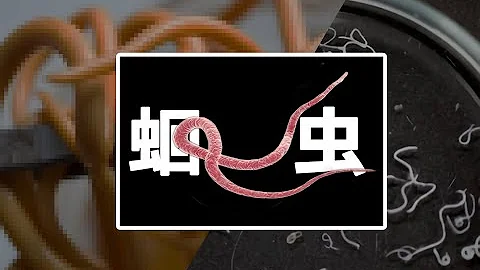 你的肚子里有多少蛔蟲？| 寄生蟲病有多可怕？|貓脫MaoTalk - 天天要聞