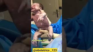 New normal birth ️    Funny newborn  #viralvideo #cuteness #pregnancy #funnybaby #new #best