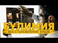 Булимия и восстановление зубов (часть 1)