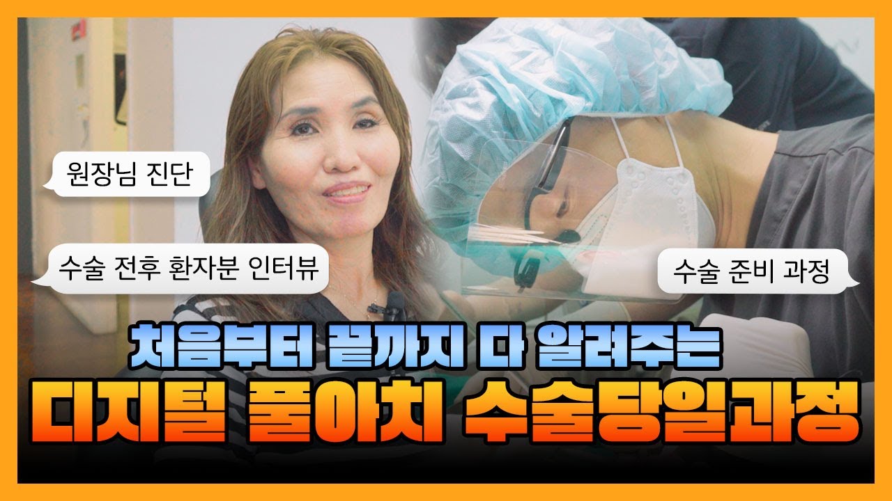 전악 풀아치 임플란트의 수술 당일 모든 과정을 보여드리겠습니다! 🦷