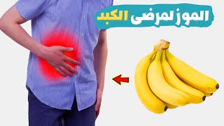 أضرار الموز لمرضى الكبد