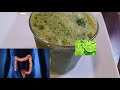 3 Jugos para Limpiar el Colon y Desintoxicar - Natural ...