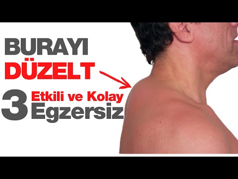 Boyun Kamburu Nasıl Düzelir? Boyun düzleşmesi ve Boyunda Oluşan Şişlik için Etkili 3 Egzersiz