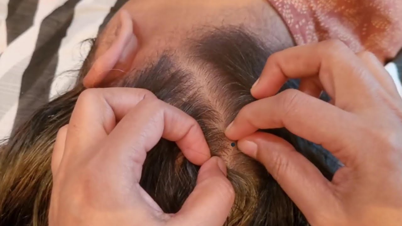 ASMR Scalp Treatment - Tingle Your Troubles Away