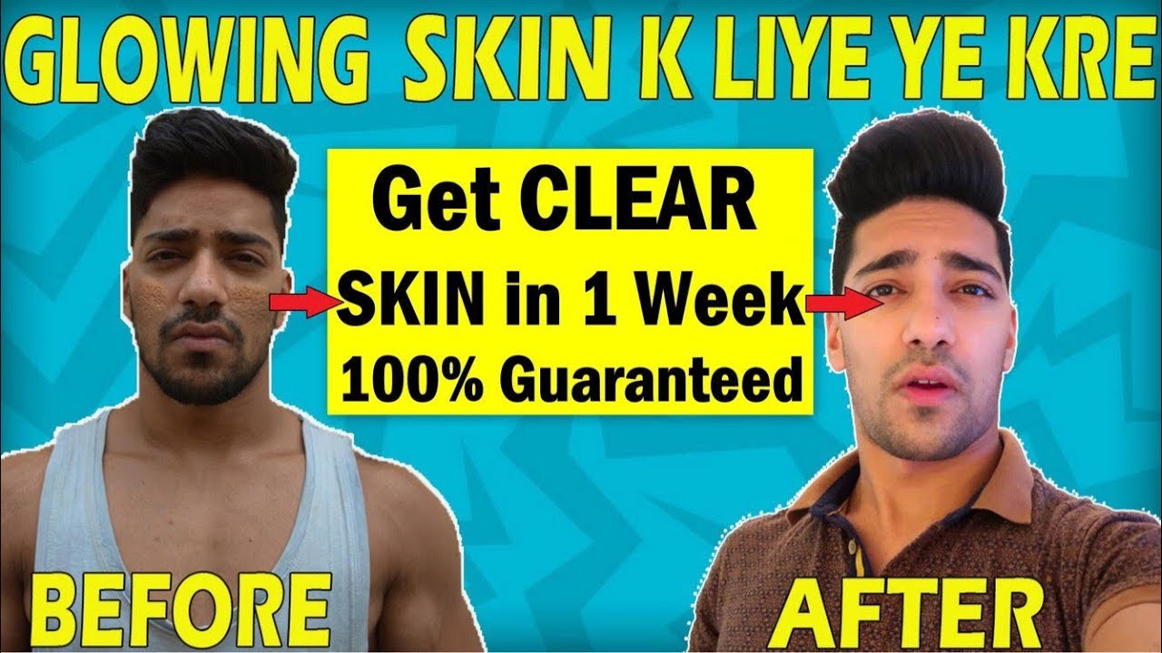 Get Clear & Glowing Skin in 1 Week | Skin Whitening Home Remedy | Skin ...